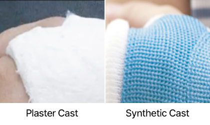 Synthetic Casting Materials – Mtex Inc.